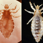 The human head louse, left, and body louse, right, are the same species, but differ in their ability to transmit disease to their host. Researchers now think they know why.