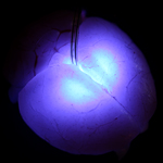 VIEW VIDEO Ultra-miniaturized LEDs injected deep into the brain illuminate mysteries of neuroscience. The light triggers very targeted neurons, providing insight into structure, function, and complex connections within the brain.