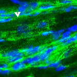 Treatment with stem cells derived from blood vessels spurred nestin-positive stem cells already present in the heart to form new cardiac muscle cells (see arrows).