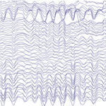 Those whose brain waves oscillated most powerfully in the alpha spectrum (about 10 times per second) when measured at the front of the head (left EEG readout) tended to learn at a faster rate than those whose brain waves oscillated with less power (readout on the right), the researchers found.