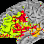 A new study found that specific structures, primarily on the left side of the brain, are vital to general intelligence and executive function (the ability to regulate and control behavior). Brain regions that are associated with general intelligence and executive function are shown in color, with red indicating common areas, orange indicating regions specific to general intelligence, and yellow indicating areas specific to executive function.