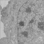 The new technique exposes living cells to labeled antibodies, an approach that yields a much stronger signal for electron microscopy.