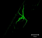 A new approach to culturing neurons developed at Illinois extends the lifespan of the neurons at very low densities, an essential step toward developing a method for studying the growth and behavior of individual brain cells. The cultured neurons look more like mature cells than those grown at low densities using conventional techniques.