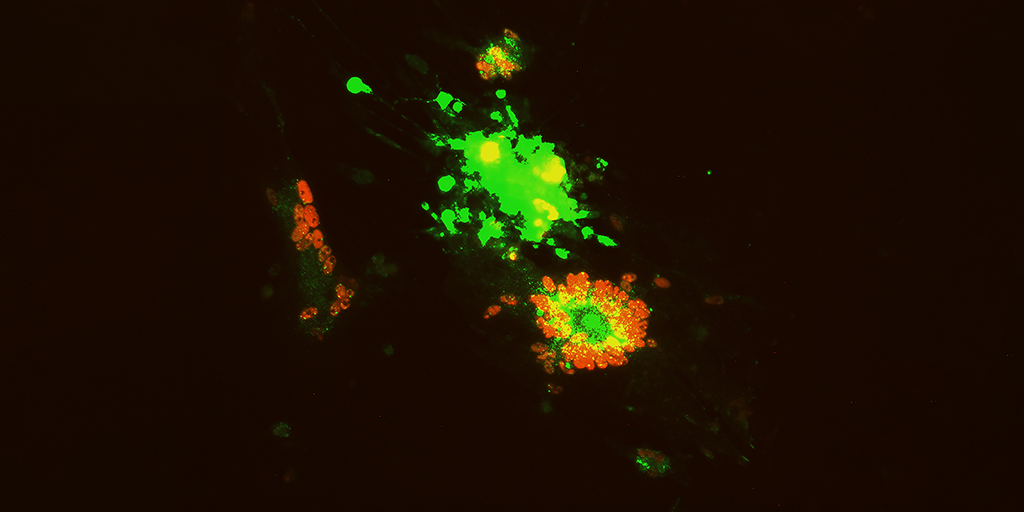 Photo showing some cells lit green, some lit red and some glowing yellow.