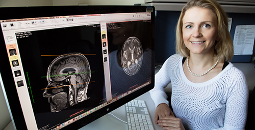 University of Illinois Beckman Institute postdoctoral researcher Agnieszka Burzynska and her colleagues found that physical activity and sedentary behavior are each associated with specific differences in brain white matter integrity.