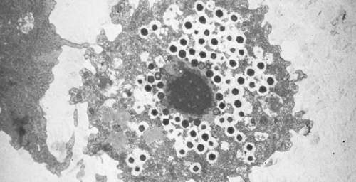Giant viruses should be included reconstructions of the tree of life, researchers report in a new study. The mimivirus, shown here (small black hexagons) infecting an amoeba, is as big as some bacterial cells and shares some ancient protein structures with most organisms.