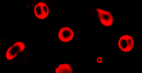 A research team led by electrical and computer engineering professor Gabriel Popescu used a novel measurement technique called diffraction phase microscopy to reveal the mechanics of red blood cells.