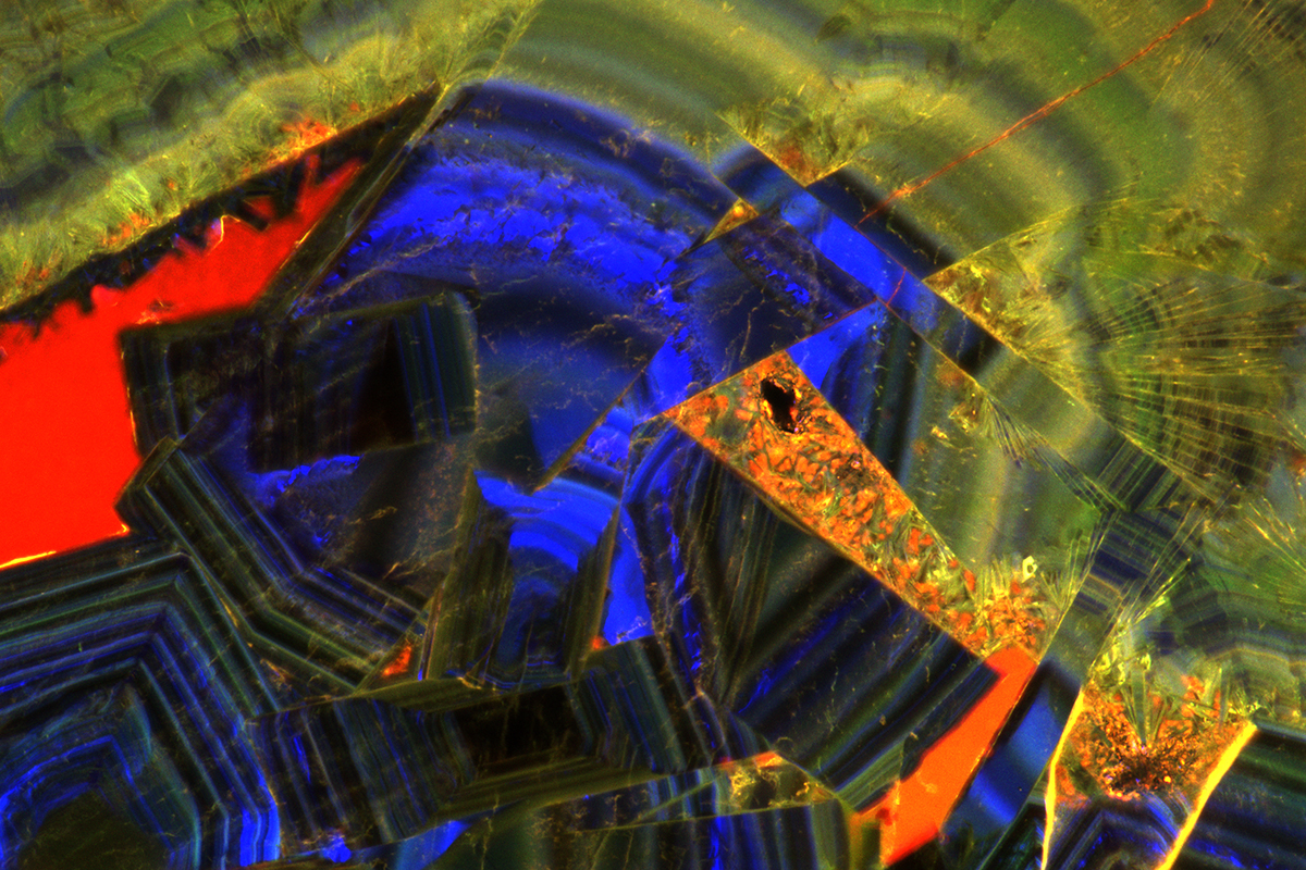 A microscope image of brilliantly colored crystals in a kidney stone.
