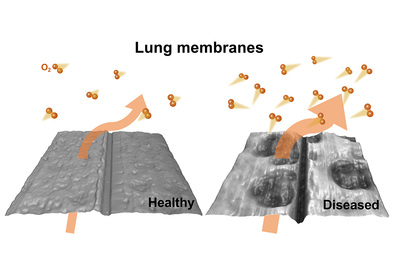 New research from engineers at the University of Illinois at Urbana-Champaign shows how oxygen transfer is altered in diseased lung tissue.