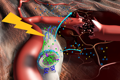 An artist's rendering of a nanostimulator attached to a fat-derived stem cell in damaged muscle tissue.
